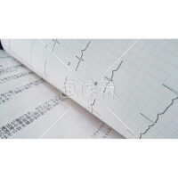 心電図がある無料写真